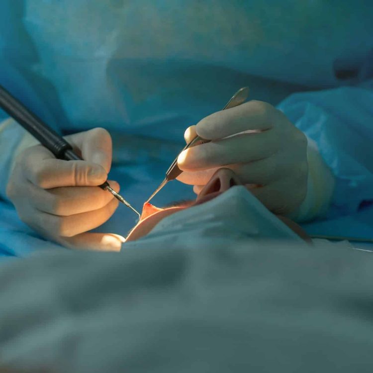 ophthalmologist performs an operation on the patient's eye.